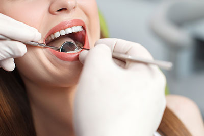 Non-Surgical Periodontal Treatment in San Marino